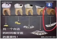 3shape牙科扫描仪（3shape口腔扫描仪需要年费吗）