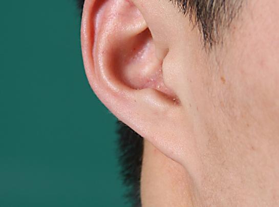 为什么男生的耳朵是禁区