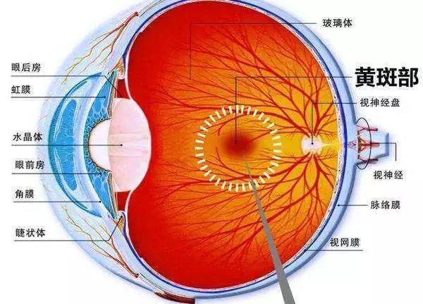 什么是眼底黄斑 会失明吗 如何治疗