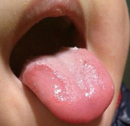 婴儿舌头上的东西需要洗吗（小婴儿舌头上的东西怎么清理）