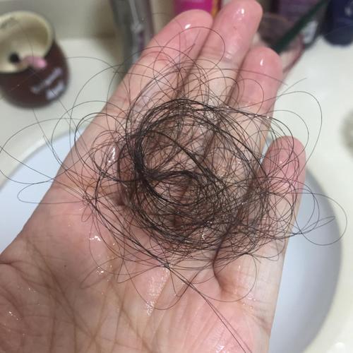 洗一次头发掉多少根算是正常（三天洗一次头发掉多少算正常的）