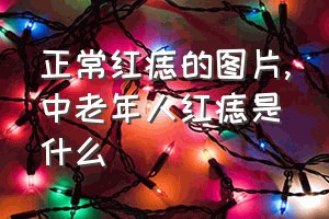 正常红痣的图片（中老年人红痣是什么）